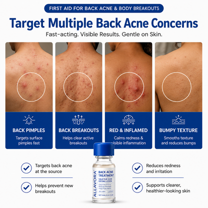 Allavora Back Acne Treatment