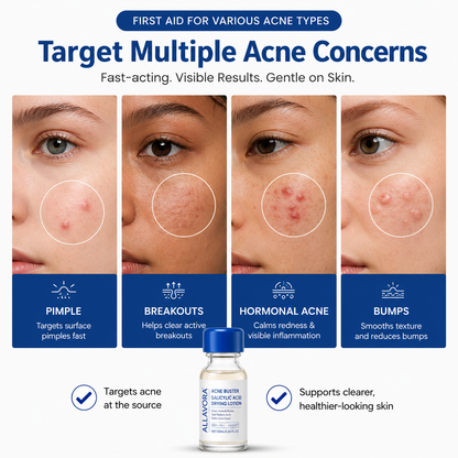 Allavora Overnight Acne Treatment
